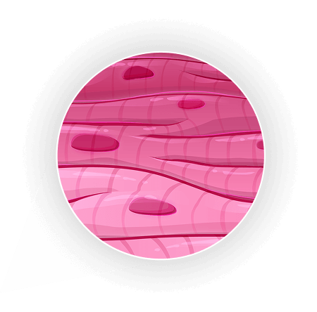 Magnified heart: obstructive HCM causes excessive contractions in the heart muscle